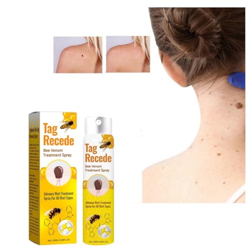 Bienengift Spray zur Entfernung von Hautflecken, Tag Recede Bienengift-Behandlungsspray, Tag Recede Bee Venom Spray für Alle Hauttypen 20ml