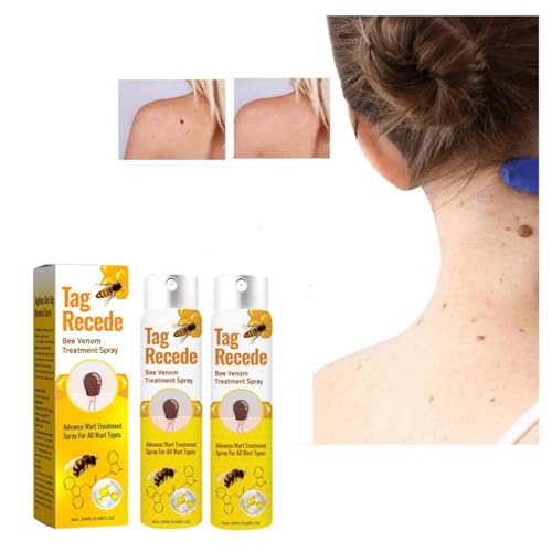 Bienengift Spray zur Entfernung von Hautflecken, Tag Recede Bienengift-Behandlungsspray, Tag Recede Bee Venom Spray für Alle Hauttypen 20ml