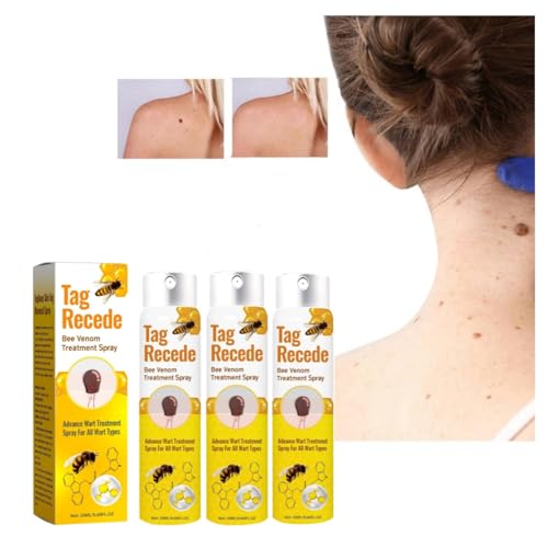 Bienengift Spray zur Entfernung von Hautflecken, Tag Recede Bienengift-Behandlungsspray, Tag Recede Bee Venom Spray für Alle Hauttypen 20ml