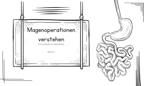 Magenoperationen verstehen: Ein Leitfaden für Betroffene