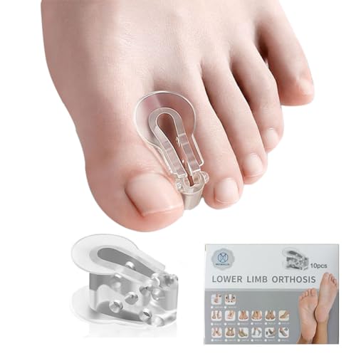 MEMNUN's weiche und hochelastische SEBS Zehentrenner, Hallux Valgus, Ballenzeh, Hammerzeh, überlappender Zehenkorrektor, Yoga Zehentrenner, 10 Stück