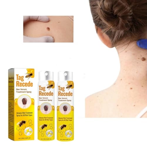 Tag Recede Bienengift-Behandlungsspray, Bienengift Spray zur Entfernung von Hautflecken, Tag Recede Bee Venom Spray für Alle Hauttypen 20ml