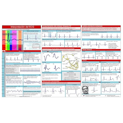 Generisch EKG Pocket Guide, EKG-Rhythmusinterpretation, EKG-Interpretationstaschenkarte, Doppelseitige Kompakte Tragbare Referenzkarte, Faltbar EKG Pocket Nurses Guide (1PC)