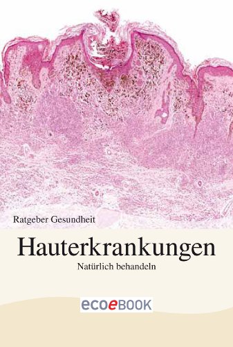 Hautkerkrankungen (Ratgeber Gesundheit)