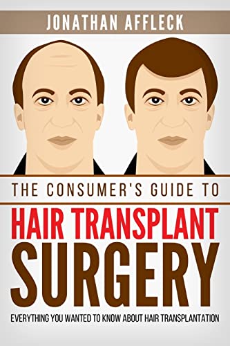 The Consumer's Guide to Hair Transplant Surgery: Everything You Wanted to Know About Hair Transplantation