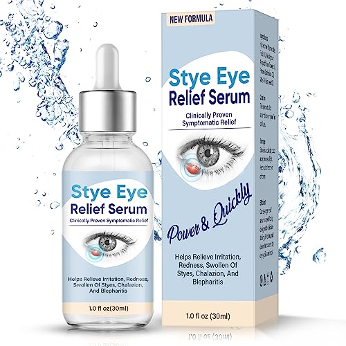 Stye Eye Treatment, Blepharitis Treatment, Natural Stye Treatment Drops for Styes Chalazion and Blepharitis