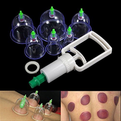 Hiibaby® 6 Tassen traditionelle Körperpflege chinesische medizinische Vakuum-Körper Schröpfset Massagemagnete Therapie Akupressur Gesunde Saugnapf Set Ausrüstung KN6